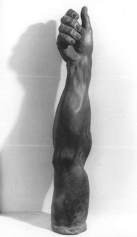 Arm